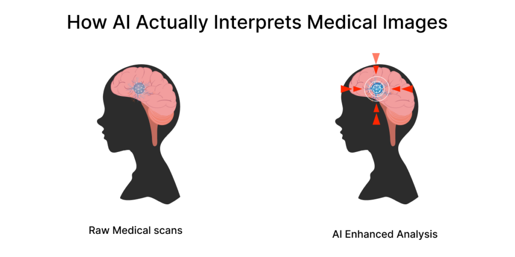 How AI Actually Interprets Medical Images
